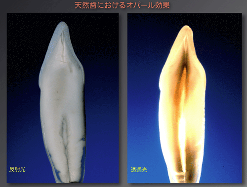 図07 天然歯のオパール効果
